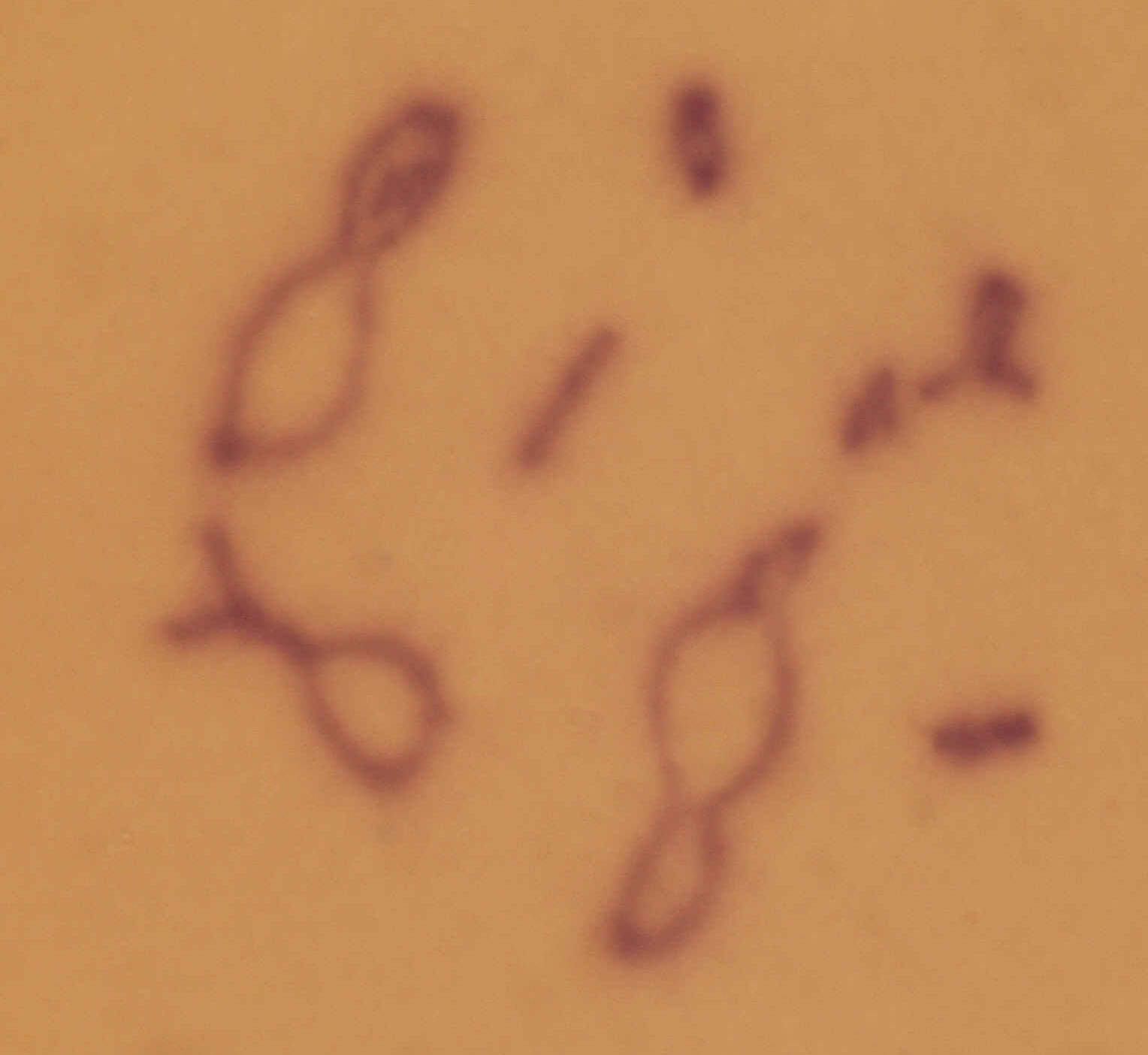 Chorthippus_albomarginatus_karyo_1
