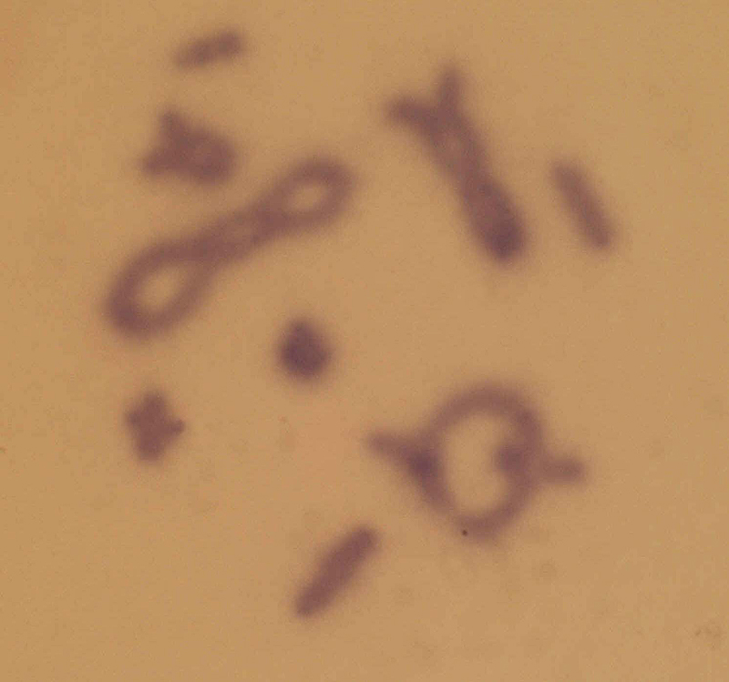 Chorthippus_parallelus_karyo_0