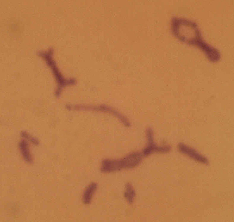 Euchorthippus_pulvinatus_karyo