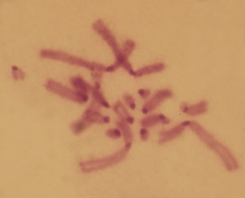 Euchorthippus_pulvinatus_karyo_03