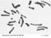 Bryodema_orientale_karyo