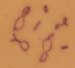 Chorthippus_albomarginatus_karyo_02