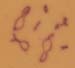 Chorthippus_albomarginatus_karyo_1