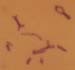 Euchorthippus_pulvinatus_karyo_02